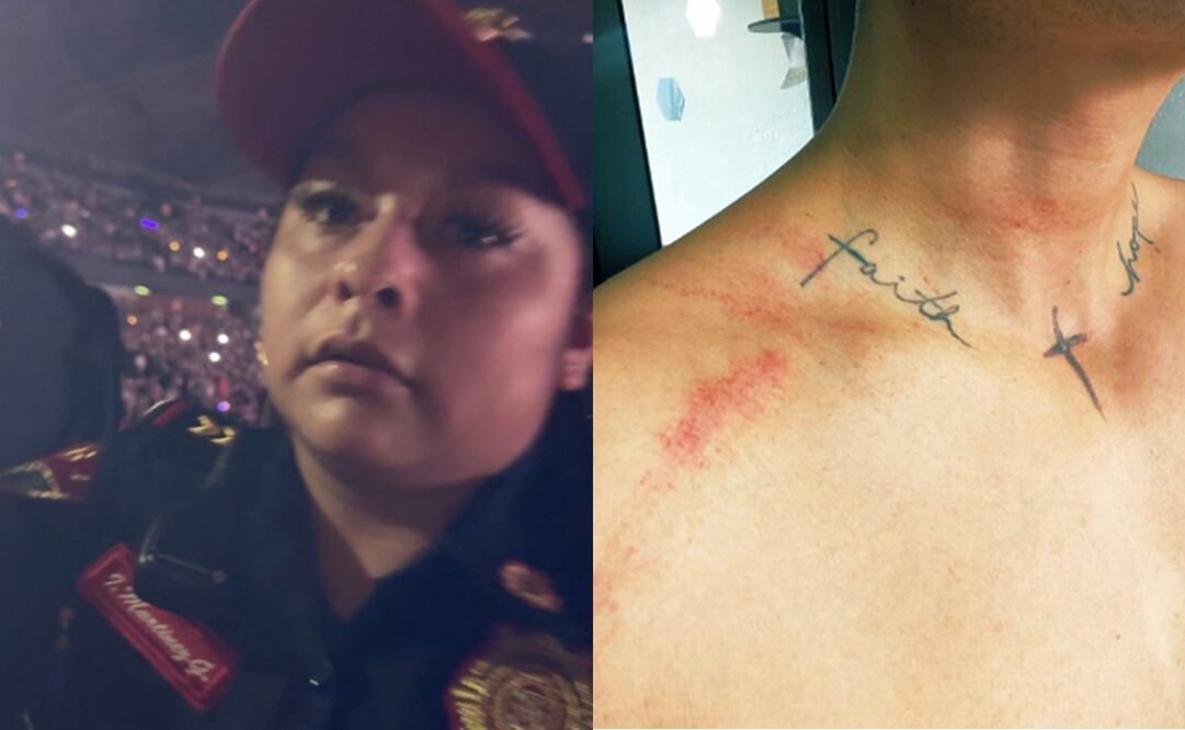 Joven denuncia agresión física por parte de policías en concierto de Madonna. Fotos: Captura de pantalla