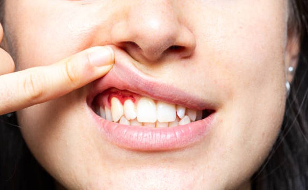 La dependencia señaló que la producción de dichas bolsas son una táctica más de la industria tabacalera para atraer a adolescentes y jóvenes. Foto: Pixabay