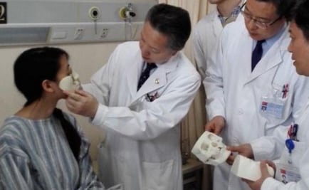 Mujer recuperará nariz y boca gracias a la impresión 3D