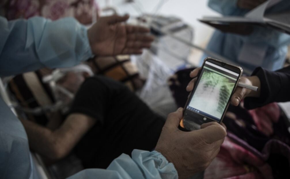 Anticuerpos contra covid-19 duran 8 meses en la mayoría de casos