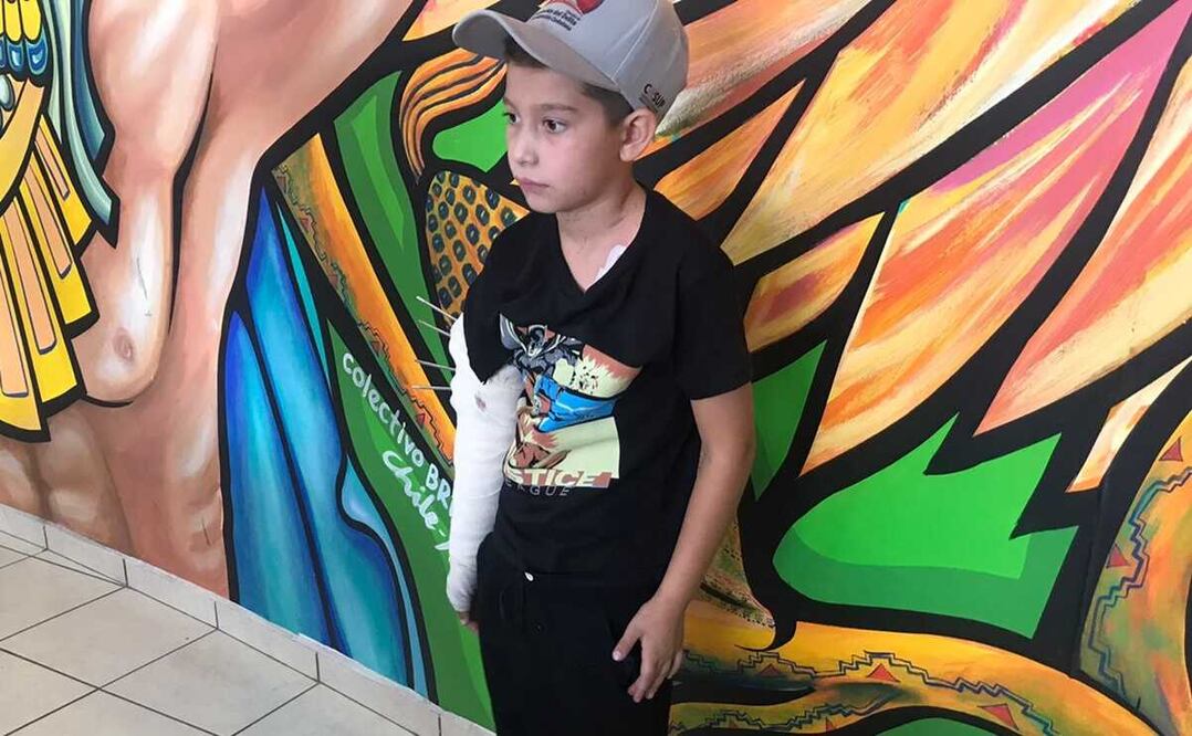 Alexis, el niño de nueve años que fue atacado por un lobo canadiense el 6 de mayo en un Zoológico de Neza. Foto: Emilio Fernández / EL UNIVERSAL 