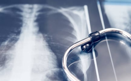 Comisión Antimonopolio sanciona a empresas coludidas en licitaciones de material para radiografías; señala afectación a salud pública