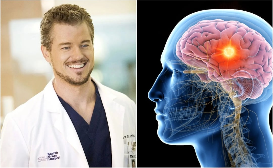 En alrededor de 10% de los casos, la ELA se puede asociar a factores genéticos. Foto: X