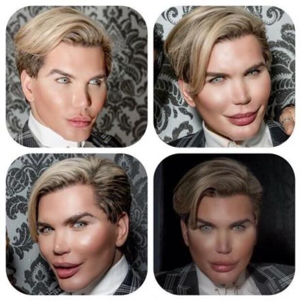 "Ken Humano" desafía la estética y se quema la piel del rostro