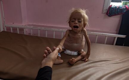 "La hambruna en Gaza se desarrolla ante nuestros ojos"; Unión Europea, Reino Unido y Japón piden acción urgente