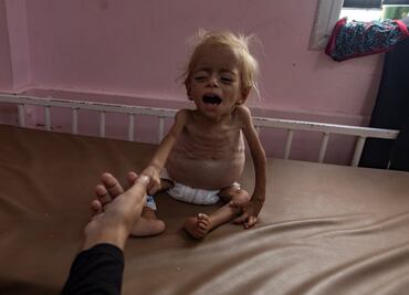 "La hambruna en Gaza se desarrolla ante nuestros ojos"; Unión Europea, Reino Unido y Japón piden acción urgente