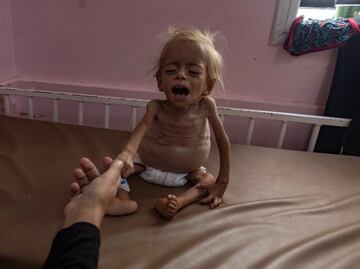 "La hambruna en Gaza se desarrolla ante nuestros ojos"; Unión Europea, Reino Unido y Japón piden acción urgente