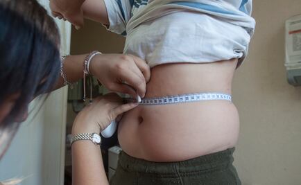 El exceso de peso no aumenta el riesgo de infarto