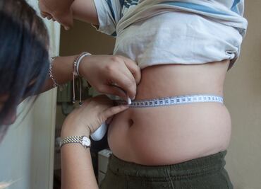 El exceso de peso no aumenta el riesgo de infarto