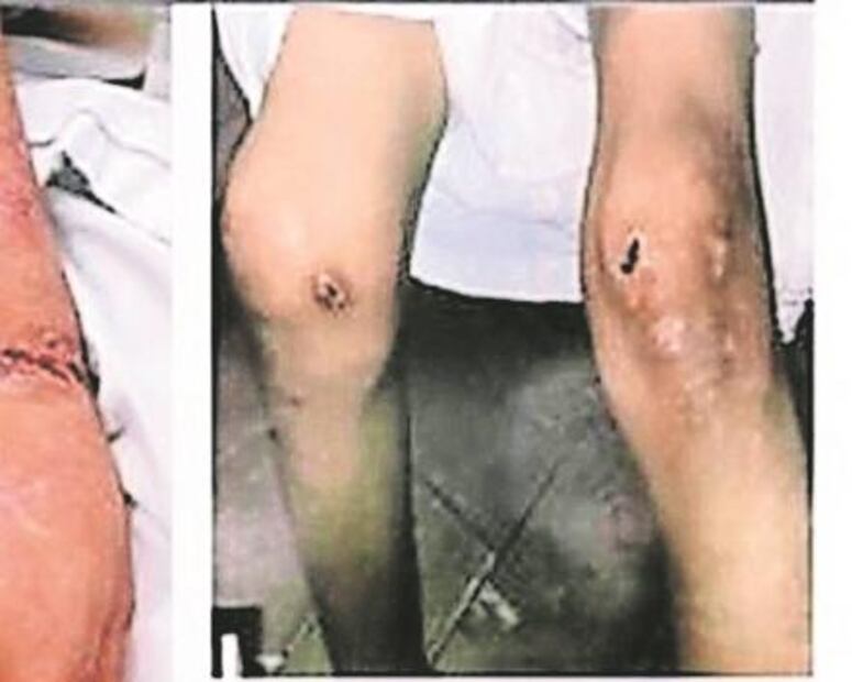 El Foco. "Big Brother" en la ciudad, las fotomultas andan sueltas