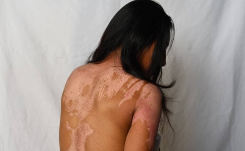 Fotógrafo de EL UNIVERSAL es reconocido con Premio Alemán de Periodismo Walter Reuter