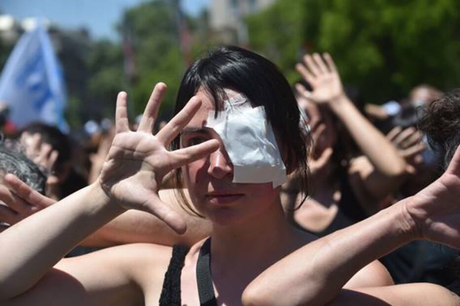 “31 Minutos” se solidariza con heridos en protestas de Chile