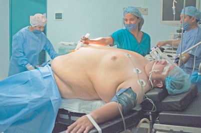 Súper obesidad gana terreno en México