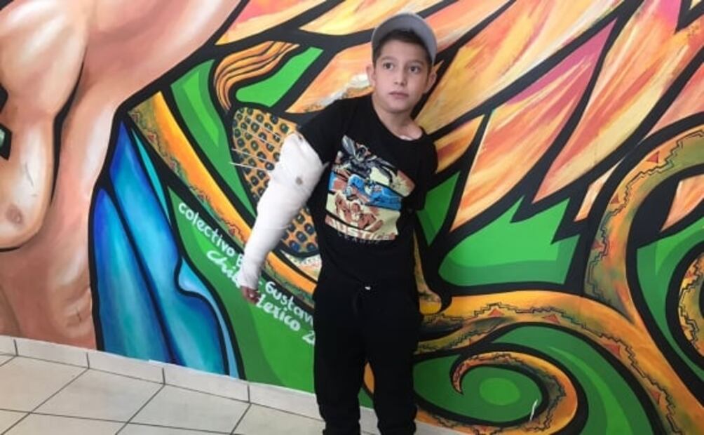 "La primera vez lo acaricié, a la segunda me mordió”; se recupera el niño mordido por un lobo en zoo de Neza