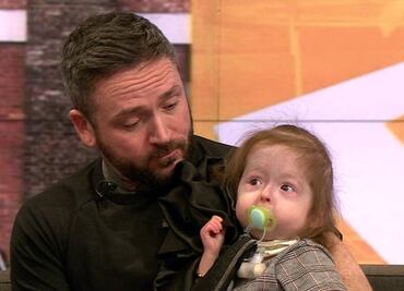 La niña de 2 años con una condición única que acelera su envejecimiento