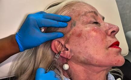 Laura Zapata presume nuevo rostro a los 68 años; la critican y responde: "sigan escupiendo veneno"