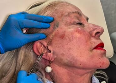 Laura Zapata presume nuevo rostro a los 68 años; la critican y responde: "sigan escupiendo veneno"