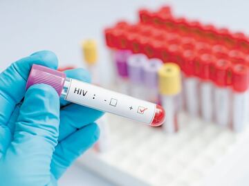 Revelan que tratamiento con proteínas sintéticas conduciría a la cura del VIH: estudio