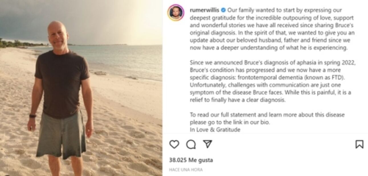 Salud de Bruce Willis empeora, ahora es diagnosticado con demencia