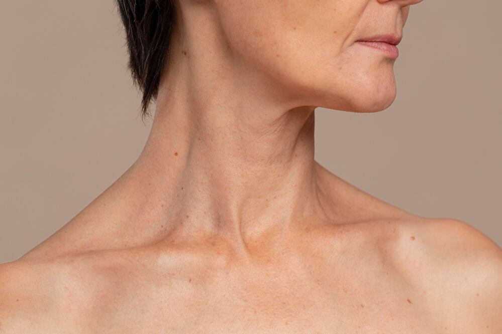 Las arrugas y la flacidez delatan la edad en el cuello. Foto: Freepik