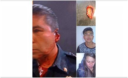 Jóvenes arrancan oreja a policía en el Metro 