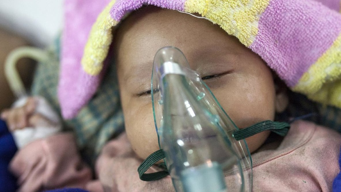 Cerca de 1.4 millones de niños fallecen cada año a causa de la neumonía, la principal causa de muerte en menores de 5 años en el mundo. Foto: Getty Images 