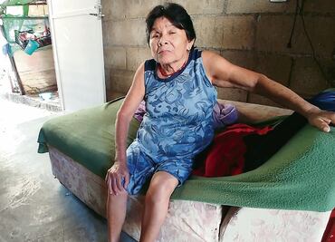 Pierde el ojo tras cirugía de campaña de Cinépolis