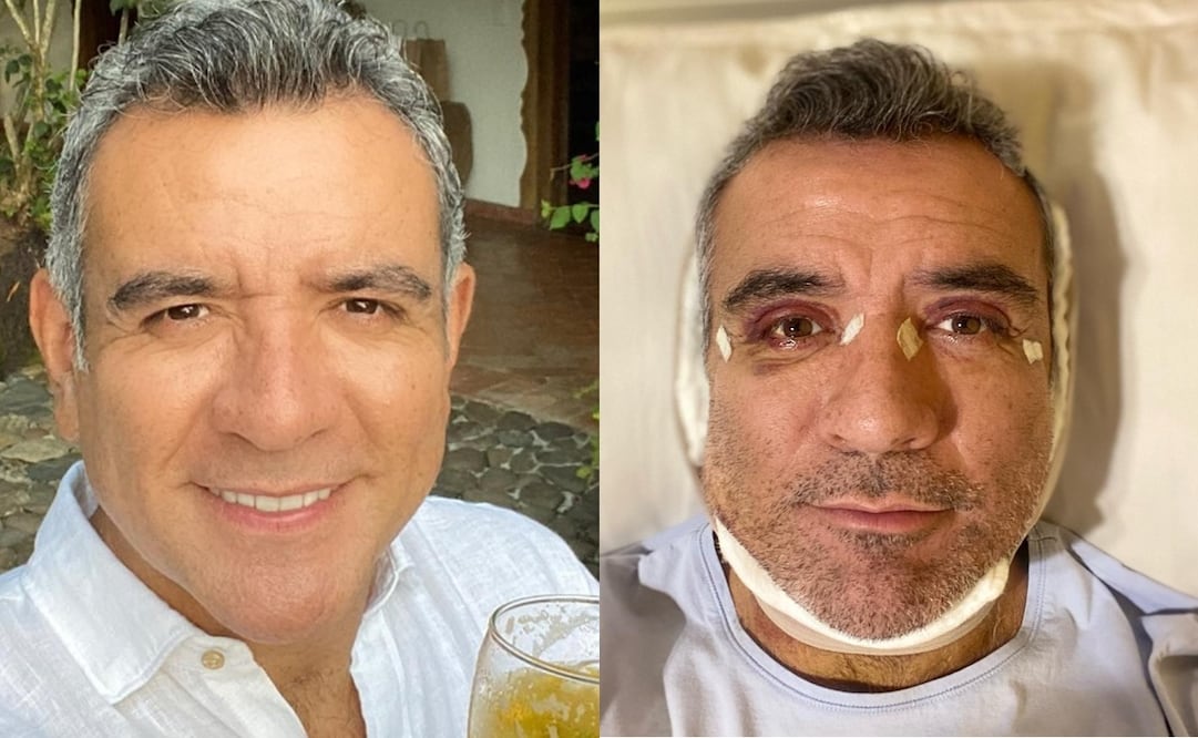 El actor Héctor Sandarti se hizo algunos arreglos estéticos. Foto: Vía Instagram oficial.