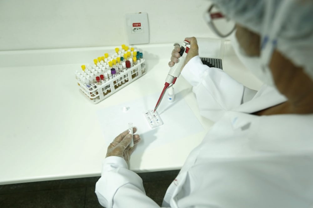 En Brasil habrá pruebas de detección rápidas del virus (XINHUA)