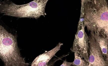 Regeneran músculos con células madre dentales