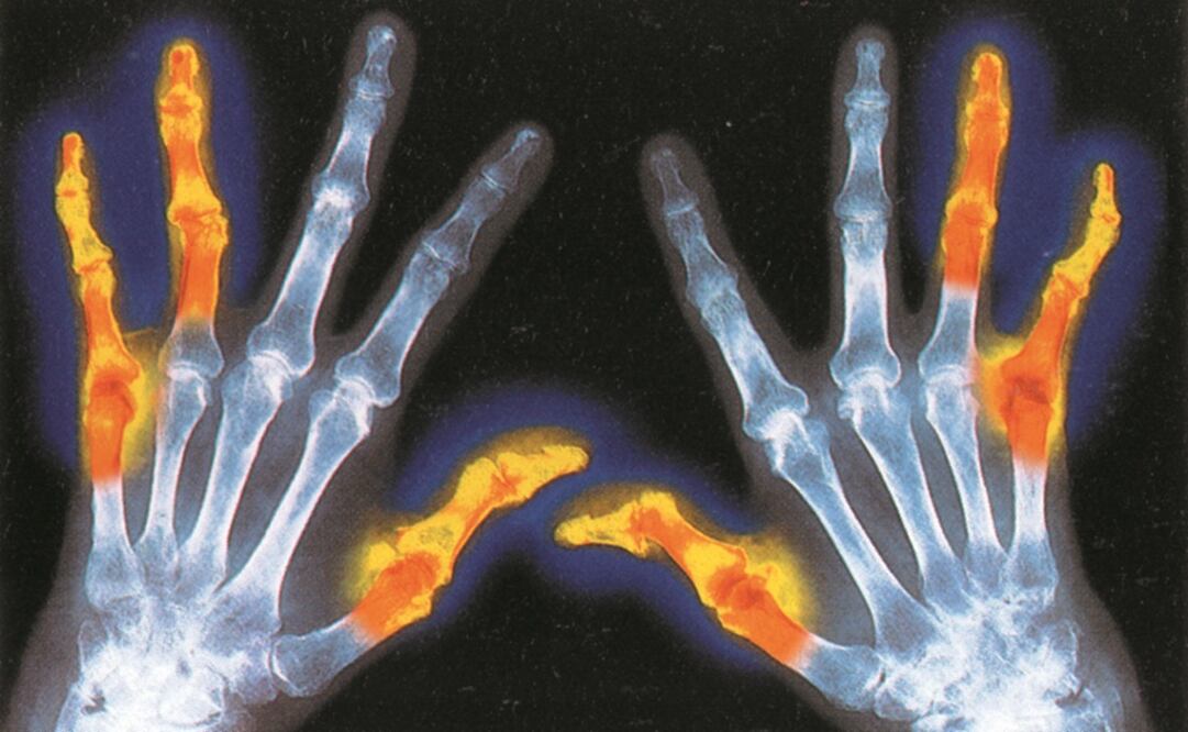 (Foto: Archivo - EL UNIVERSAL)