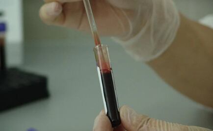 Científicos presentan terapia celular innovadora para tratar cáncer de sangre 