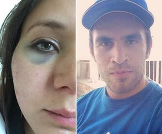 Joven denuncia agresión de su novio a través de Facebook