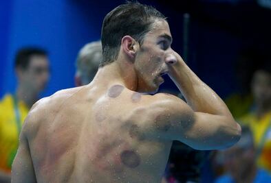 El "cupping" de Michael Phelps, medicina recomendada por el profeta Mahoma