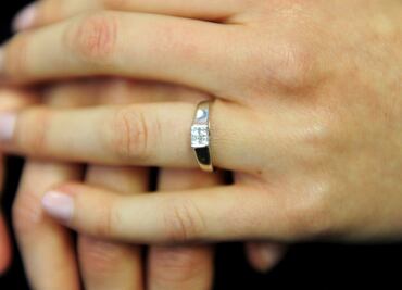 La mujer que se tragó su anillo de compromiso mientras dormía