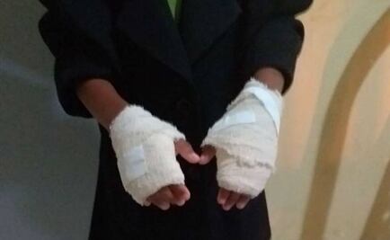 Brasileña quema manos a su nieta como castigo por "portarse mal"