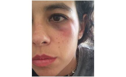 Indagan a policía por golpear a mujer