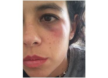 Indagan a policía por golpear a mujer