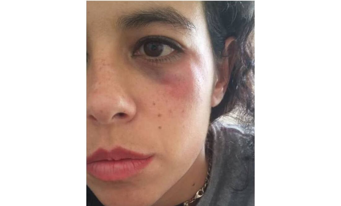 Indagan a policía por golpear a mujer