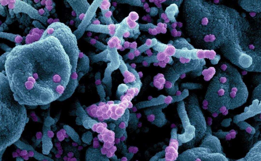 Foto: EFE/EPA/NIAID/NATIONAL INSTITUTES OF HEALTH 