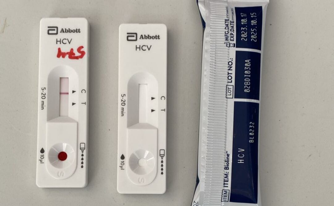 Hepatitis C es una infección viral que daña al hígado. La forma en la que se transmite es principalmente por contacto con sangre infectada. Foto: Especiales