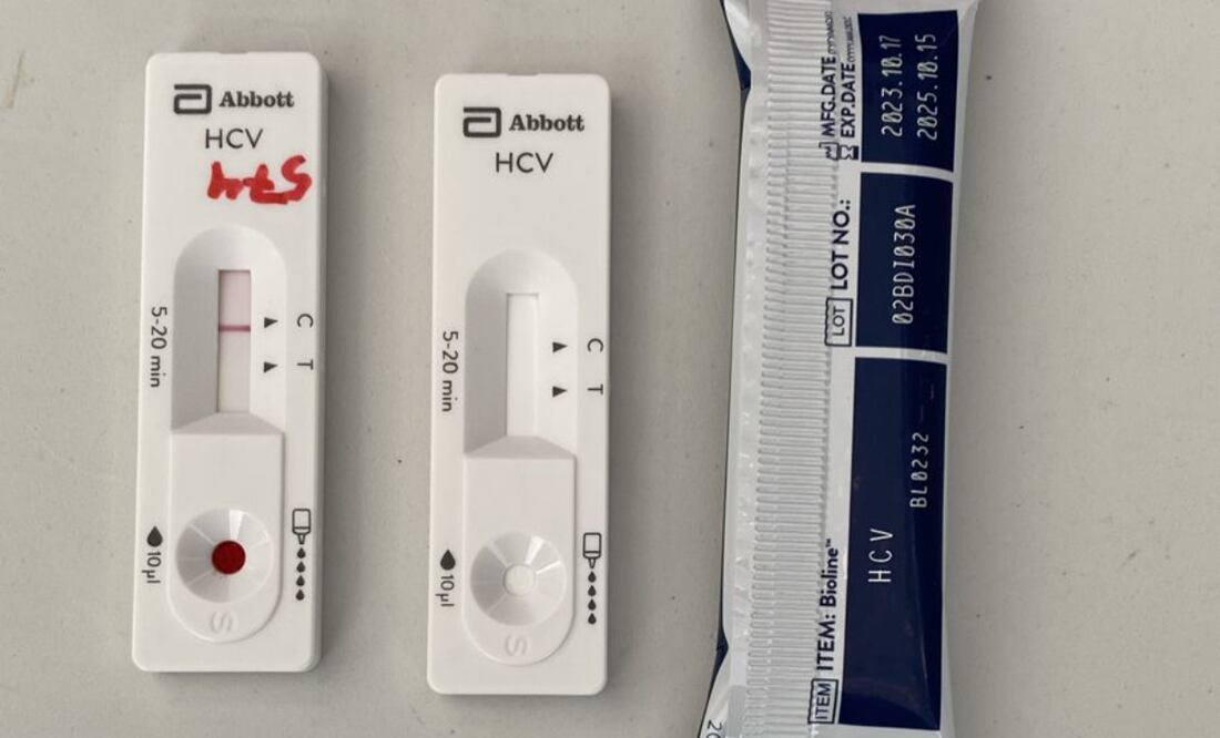 Hepatitis C es una infección viral que daña al hígado. La forma en la que se transmite es principalmente por contacto con sangre infectada. Foto: Especiales