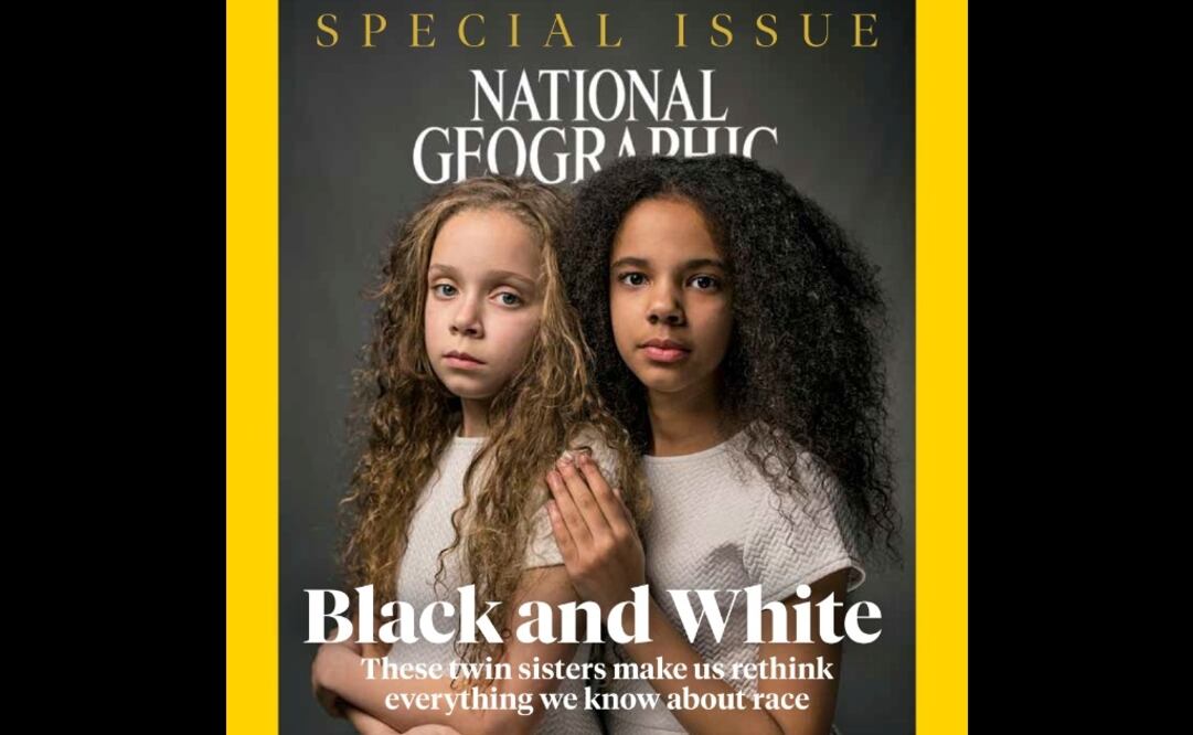 La revista National Geographic abordará en su edición de abril el racismo. Foto: National Geographic vía AP