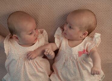 Cesárea, factor de riesgo para el desarrollo psicológico en gemelos