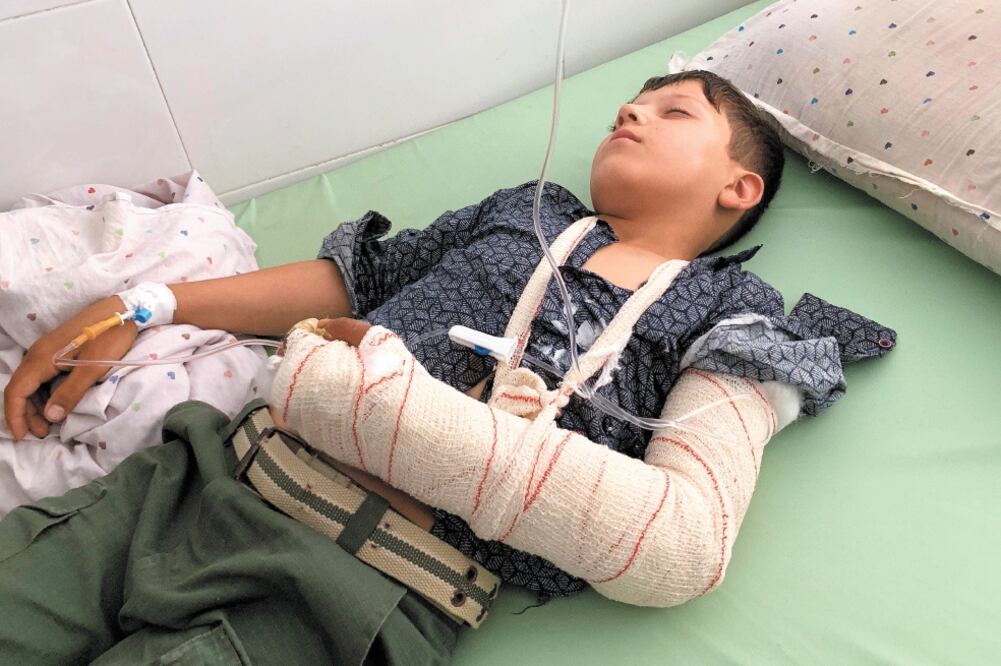 Un niño fue herido durante el atentado en un mitin del presidente Ashraf Ghani, en Kabul. Foto: HEDAYATULLAH AMID. EFE
