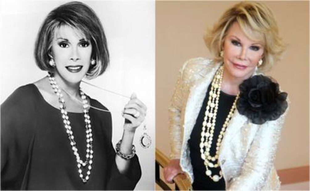 Personalidades de la moda que se pasaron de cirugías