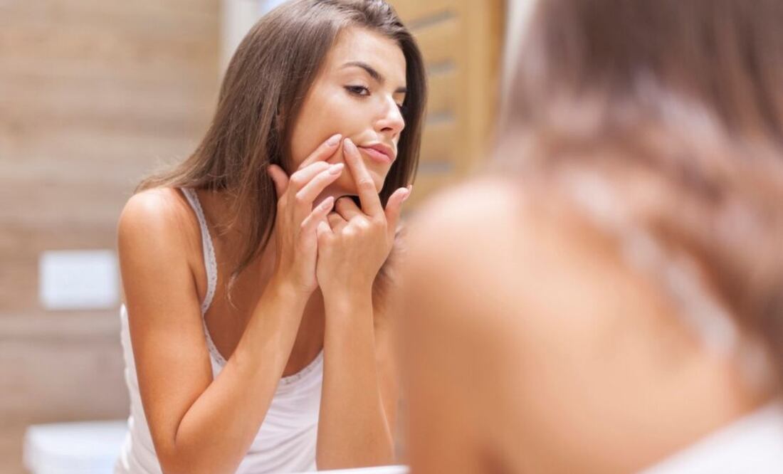 Combatiendo el acné fastidioso. Fuente: Freepik.