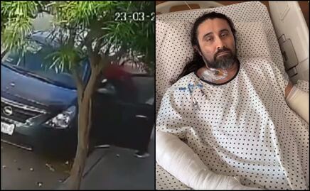 Atacan al comediante yucateco “Taco de Ojo”; le dieron 20 puñaladas