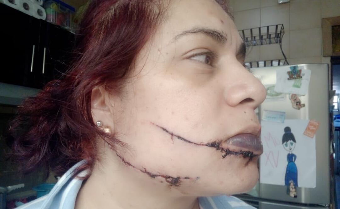 Fotografías cortesía de la víctima