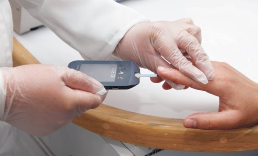 La fruta que ayuda a reducir la glucosa en la sangre. Foto: Archivo / EL UNIVERSAL